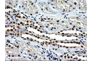 Image no. 2 for anti-EPM2A (Laforin) Interacting Protein 1 (EPM2AIP1) antibody (ABIN1498046) (EPM2AIP1 antibody)