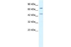 WB Suggested Anti-KLHL25 Antibody Titration:  0.