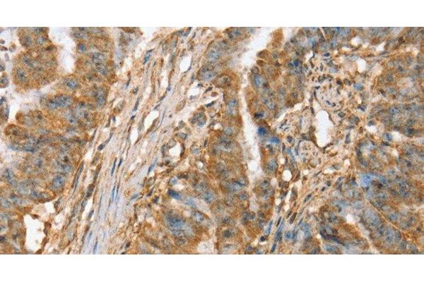 SLC41A2 antibody