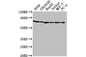 Western Blot Positive WB detected in: A549 whole cell lysate, COLO320 whole cell lysate, HepG2 whole cell lysate, Jurkat whole cell lysate, MCF-7 whole cell lysate, PC-3 whole cell lysate All lanes: HSPA1A antibody at 1:2000 Secondary Goat polyclonal to rabbit IgG at 1/50000 dilution Predicted band size: 71, 64 kDa Observed band size: 71 kDa (HSP70 1A antibody  (AA 291-641))