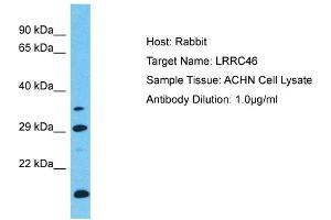 Host: Rabbit Target Name: LRRC46 Sample Type: ACHN Whole Cell lysates Antibody Dilution: 1. (LRRC46 antibody  (C-Term))