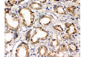 Anti- FXYZ1 Picoband antibody, IHC(P) IHC(P): Human Prostatic Cancer Tissue (FXYD1 antibody  (AA 21-92))