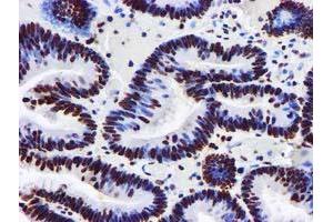 Image no. 5 for anti-Glutathione S-Transferase theta 2 (GSTT2) antibody (ABIN1498553) (GSTT2 antibody)