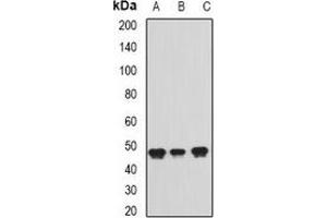 Western blot analysis of ADE2 expression in Jurkat (A), Raji (B), Hela (C) whole cell lysates.