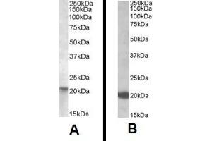 Western Blotting (WB) image for anti-GTPase NRas (NRAS) (Internal Region) antibody (ABIN2466026) (GTPase NRas antibody  (Internal Region))
