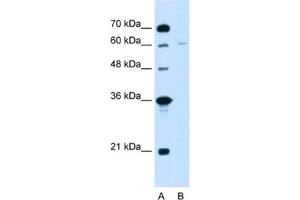 Western Blotting (WB) image for anti-Chromatin Assembly Factor 1, Subunit B (p60) (CHAF1B) antibody (ABIN2462905) (CHAF1B antibody)