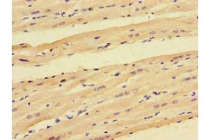 Immunohistochemistry of paraffin-embedded human heart tissue using ABIN7165923 at dilution of 1:100