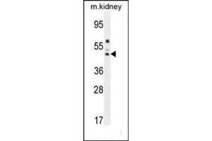 Western blot analysis of SERPINA6 Antibody (Center) Cat.