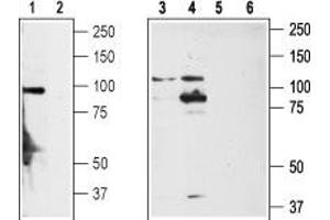 Western blot analysis of rat DRG (lanes 1,2), non-differentiated PC12 cells (lanes 3,5) and differentiated PC12 cells (lanes 4,6) lysates: - 1,3,4. (TRPA1 antibody  (1st Extracellular Loop))