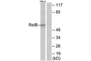Western blot analysis of extracts from HeLa cells, using RelB (Ab-552) Antibody. (RELB antibody  (AA 530-579))