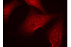 Immunofluorescence (IF) image for anti-Nuclear Factor-kB p65 (NFkBP65) (pSer311) antibody (ABIN1870583) (NF-kB p65 antibody  (pSer311))