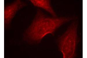 Immunofluorescence (IF) image for anti-Nuclear Factor-kB p65 (NFkBP65) (pSer311) antibody (ABIN1870583) (NF-kB p65 antibody  (pSer311))