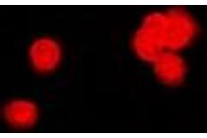 Immunofluorescent analysis of PPP2R4 staining in MCF7 cells. (PPP2R4 antibody)