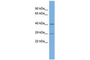 Image no. 1 for anti-N-Acetyltransferase 15 (NAT15) (C-Term) antibody (ABIN6743480) (NAT15 antibody  (C-Term))