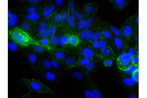 Human epithelial carcinoma cell line HEp-2 was stained with Mouse Anti-Human CD44-FITC followed by DAPI. (CD44 antibody  (FITC))