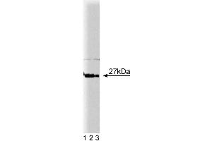 Western blot analysis of p27[Kip1] on HeLa cell lysate. (CDKN1B antibody  (AA 1-197))