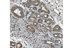 IHC analysis of ULBP1 using anti ULBP1 antibody (ABIN7600996).