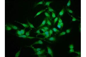 Immunofluorescence staining of Hela cells with ABIN7142099 at 1:225, counter-stained with DAPI. (14-3-3 sigma/SFN antibody  (AA 1-248))