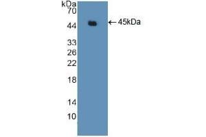 Detection of Recombinant ACTg2, Human using Polyclonal Antibody to Actin Gamma 2, Smooth Muscle (ACTg2) (ACTG2 antibody  (AA 3-376))