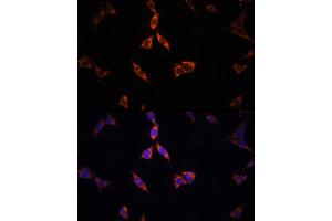 Immunofluorescence analysis of NIH-3T3 cells using  Rabbit pAb (ABIN6131387, ABIN6136467, ABIN6136469 and ABIN6222130) at dilution of 100 (40x lens). (ACSS2 antibody)