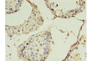 Immunohistochemistry of paraffin-embedded human testis tissue using ABIN7147867 at dilution of 1:100 (Claudin 15 antibody  (AA 72-128))