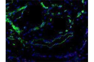 Immunofluorescence (IF) image for anti-Fms-Related Tyrosine Kinase 4 (FLT4) antibody (ABIN2665457) (FLT4 antibody)