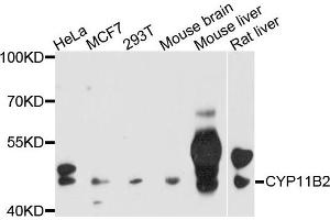 Western blot analysis of extracts of various cells，using CYP11B2 antibody. (CYP11B2 antibody)