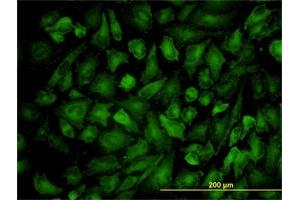 Immunofluorescence (IF) image for anti-Vinculin (VCL) (AA 1-1066) antibody (ABIN563365)