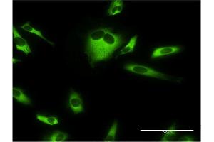Immunofluorescence (IF) image for anti-Eukaryotic Translation Elongation Factor 1 gamma (EEF1G) (AA 1-437) antibody (ABIN515174)