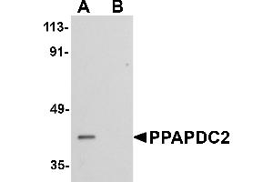 Western blot analysis of PPAPDC2 in Raji cell lysate with PPAPDC2 antibody at 1 µg/mL in (A) the absence and (B) the presence of blocking peptide.