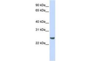 Image no. 1 for anti-NFKB Inhibitor Interacting Ras-Like 1 (NKIRAS1) (AA 36-85) antibody (ABIN6741314) (NKIRAS1 antibody  (AA 36-85))
