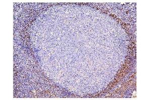 IHC analysis of ADK using anti-ADK antibody (ABIN7600222). (ADK antibody  (AA 165-351))