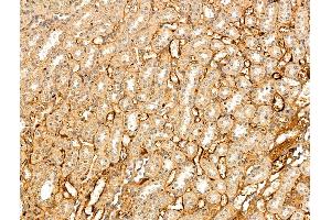 ABIN7094828 and ABIN7098879 at 1/100 staining Rat kidney tissue by IHC-P. (VLDLR antibody  (N-Term))