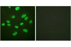 Immunofluorescence analysis of HeLa cells, using Histone H4 (Ab-16) Antibody. (Histone H4 antibody  (AA 15-64))
