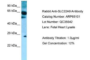 Western Blotting (WB) image for anti-Solute Carrier Family 22 (Organic Anion Transporter), Member 9 (SLC22A9) (C-Term) antibody (ABIN2790043) (SLC22A9 antibody  (C-Term))