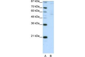 Western Blotting (WB) image for anti-Zinc Finger Protein 92 (ZNF92) antibody (ABIN2461991)