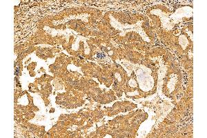 anti-Mannosidase, Alpha, Class 1A, Member 2 (MAN1A2) (Internal Region) antibody