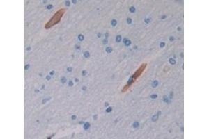Figure. (IL-37 antibody  (AA 27-192))