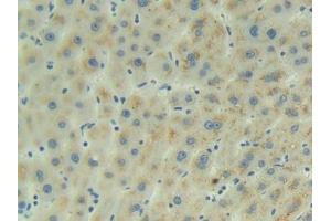 Detection of ADM in Human Liver Tissue using Polyclonal Antibody to Adrenomedullin (ADM) (Adrenomedullin antibody  (AA 22-147))