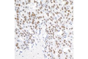 Immunohistochemistry (IHC) image for anti-Proline-, Glutamic Acid- and Leucine-Rich Protein 1 (PELP1) (AA 1000-1050) antibody (ABIN7453550) (PELP1 antibody  (AA 1000-1050))