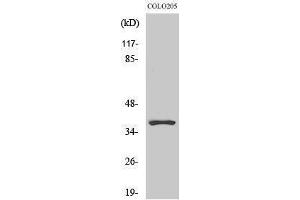 Western Blotting (WB) image for anti-Olfactory Receptor, Family 5, Subfamily K, Member 1 (OR5K1) (Internal Region) antibody (ABIN3176617)
