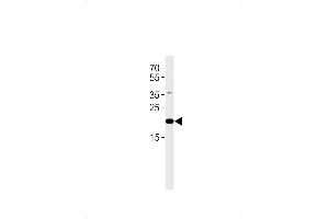 C2orf74 Antibody (C-term) (ABIN1881129 and ABIN2843610) western blot analysis in human placenta tissue lysates (35 μg/lane). (C2ORF74 antibody  (C-Term))