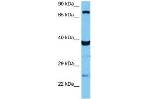 Host:  Mouse  Target Name:  TCF12  Sample Tissue:  Mouse Skeletal Muscle  Antibody Dilution:  1ug/ml (TCF12 antibody  (N-Term))
