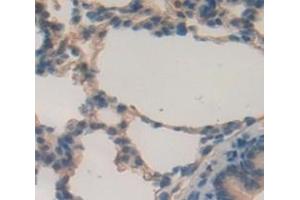 #VALUE! (MUC5B antibody  (AA 898-1002))
