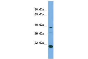 Host:  Rabbit  Target Name:  LIPT2  Sample Type:  293T Whole Cell lysates  Antibody Dilution:  1. (LIPT2 antibody  (C-Term))