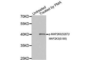 Western blot analysis of extracts of HL60 cell lines, using Phospho-MAP2K6-S207/MAP2K3-S189 antibody (ABIN5969926). (MAP2K6 antibody  (pSer207))