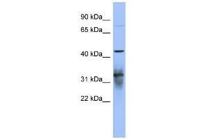 WB Suggested Anti-PABPC5 Antibody Titration:  0. (PABPC5 antibody  (N-Term))