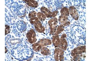 DDC antibody was used for immunohistochemistry at a concentration of 4-8 ug/ml to stain Epithelial cells of renal tubule (arrows) in Human Kidney. (DDC antibody)