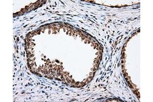 Immunohistochemical staining of paraffin-embedded liver tissue using anti-CYP1A2 mouse monoclonal antibody. (CYP1A2 antibody)