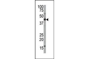 The anti-FNTA Pab (ABIN389057 and ABIN2839266) is used in Western blot to detect FNTA in mouse brain tissue lysate. (FNTA antibody  (AA 88-118))